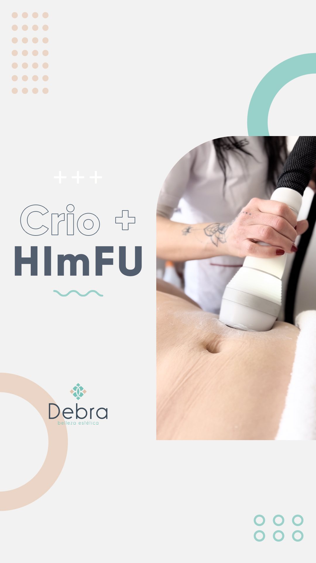 Una profesional de Debra aplica el cabezal de HIMFU sobre el abdomen de una clienta